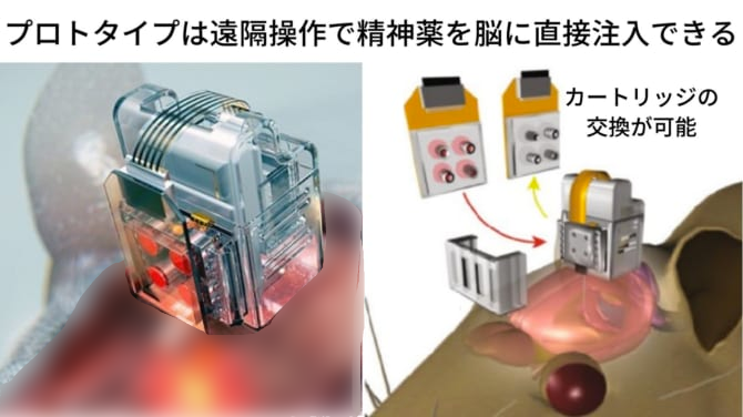 プロトタイプでは精神薬を直接脳内に注入する交換可能なカートリッジが備えられている