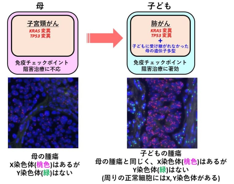 母と子どもの腫瘍の特徴の比較