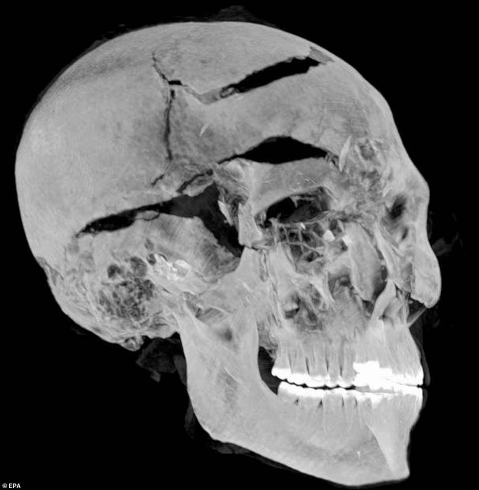 3500年前のファラオの壮絶な死因が明らかに 戦闘で「八つ裂き」にされた勇敢な王の画像
