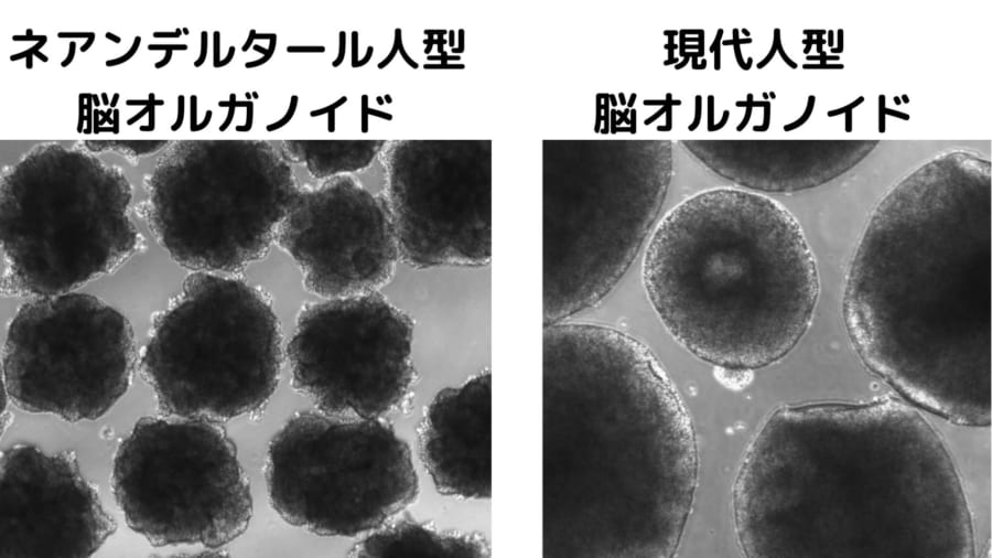 左のネアンデルタール人型の培養脳は小さくシワが多い