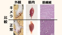 中央の筋肉は第三腓骨筋として知られている部位