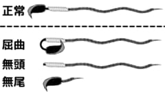 正常なマウスの精子（上）とトラプトニドによって変形した精子（下）