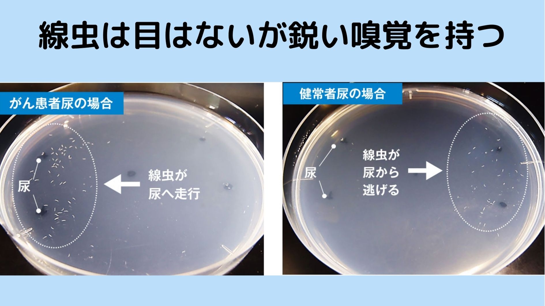 線虫の鋭い嗅覚はがん検診にも利用できる