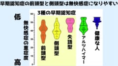 早期認知症の前頭型と側頭型は無快感症の重症度が高い