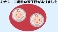 サムは子宮の中で双子の兄弟が存在した