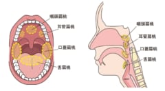 扁桃には細菌やウイルスを捉える免疫機能がある