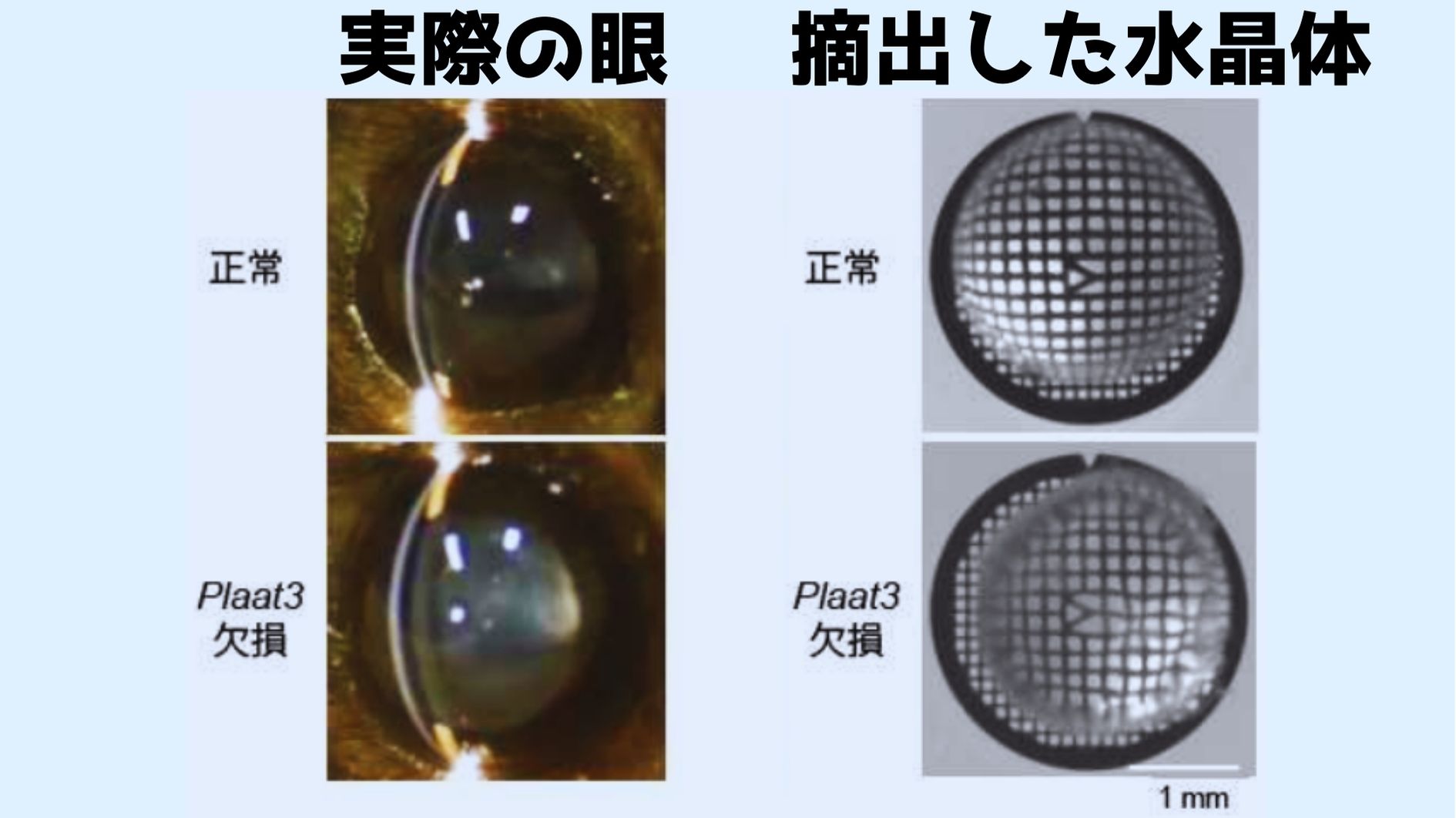 脂質分解酵素（PLAAT）がないマウスの水晶体は白濁している