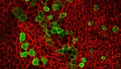 緑の部分が他の細胞から熱発生脂肪（褐色脂肪）に代わった細胞