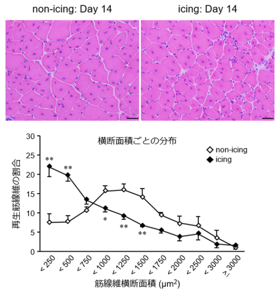 筋サンプル（上）、筋線維横断面積ごとの分布（下）