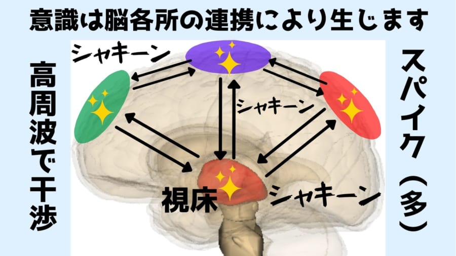 意識は脳の各所の連携により生じる