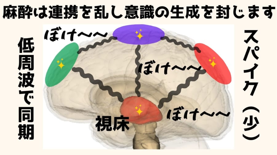 麻酔は脳の各部位の機能そのものではなく連携を乱すことで意識を奪う