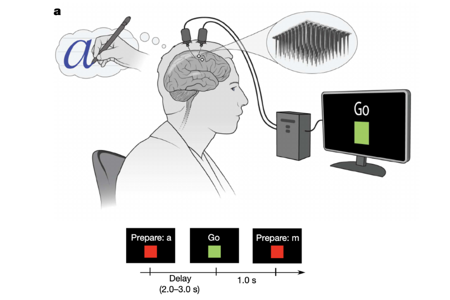 脳に埋めた電極と思考で、文字入力できる技術が誕生！その名も「マインドライティング」