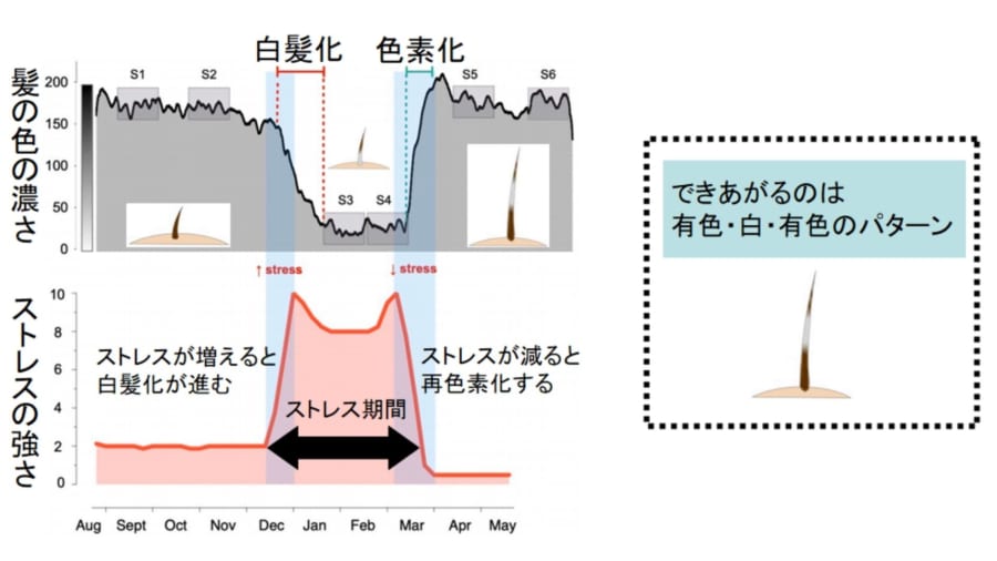 髪の白黒シマシマはストレスの有る無しによってできていた