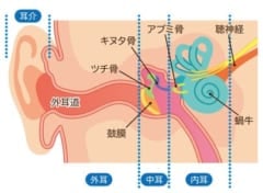 耳硬化症は内耳のアブミ骨の硬化で鼓膜の振動が伝わりづらくなる病気