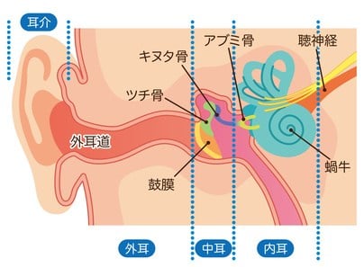 耳硬化症は内耳のアブミ骨の硬化で鼓膜の振動が伝わりづらくなる病気