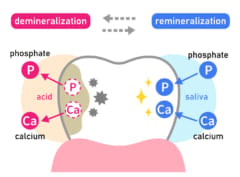 エナメル質の脱灰と再石灰化