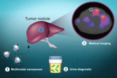 改良された製剤は尿検査だけでなく、PET検査でがんの場所を特定可能
