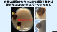 iPS細胞から目のパーツを作る「再生医療」に期待