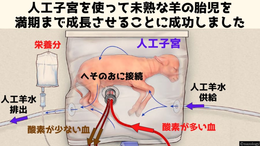 未熟児を「赤ちゃん」ではなく「胎児」として扱うことで命を救う