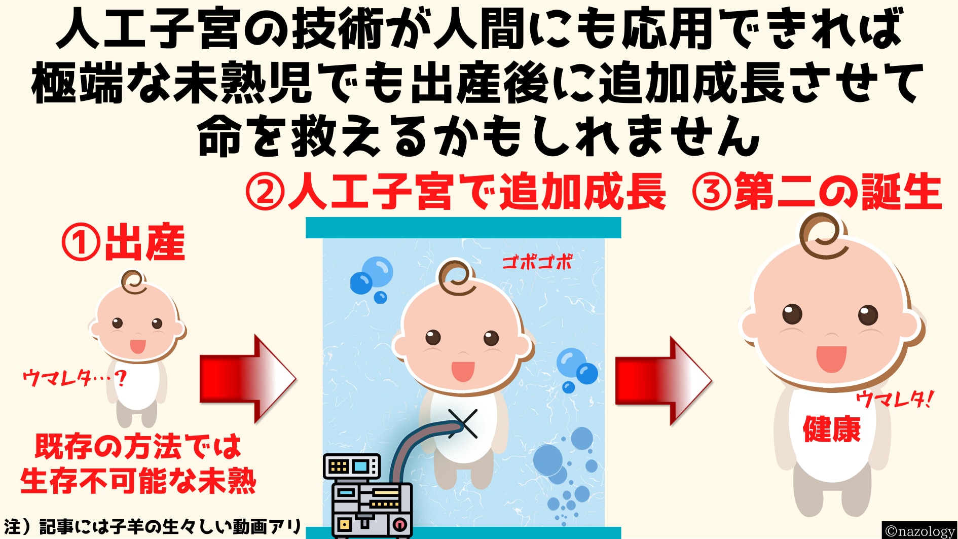 極端に未熟な状態の赤ちゃんたちを人工子宮に収容・成長させ命を救えるかもしれない