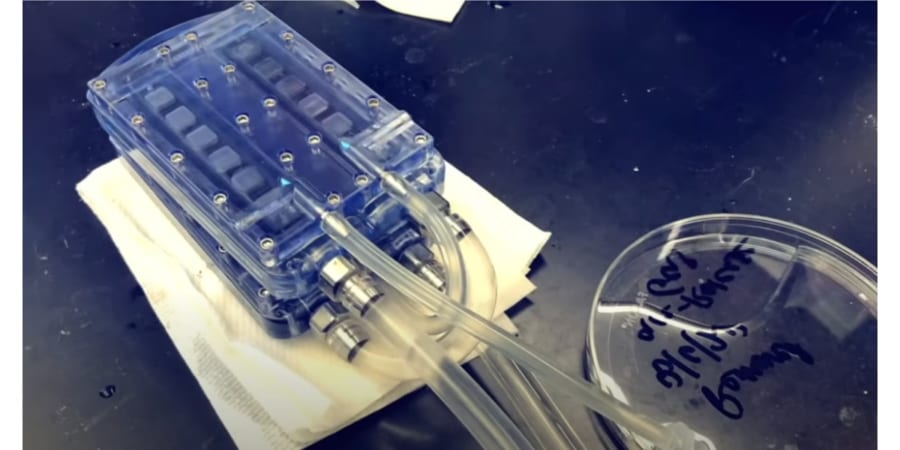 【中古】人工腎臓の実際 人工腎臓」の試作に成功！透析患者の生活の質を改善させる - ナゾロジー