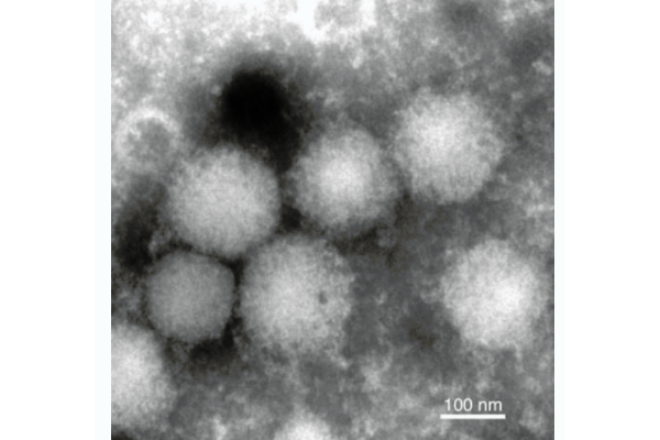 北海道で「エゾウイルス熱」を発見｜マダニが媒介する新しいウイルス感染症