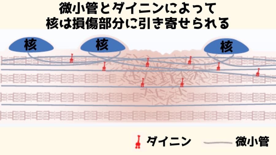 「手足」がない核は分子モーターの力でたぐり寄せられた