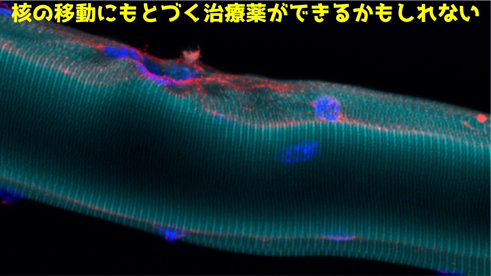 新たなメカニズムは新たな薬の開発につながる