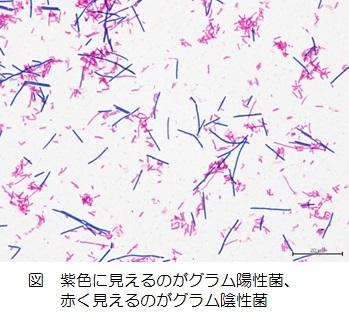 グラム染色の例