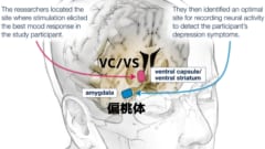 偏桃体とVC/VSの位置