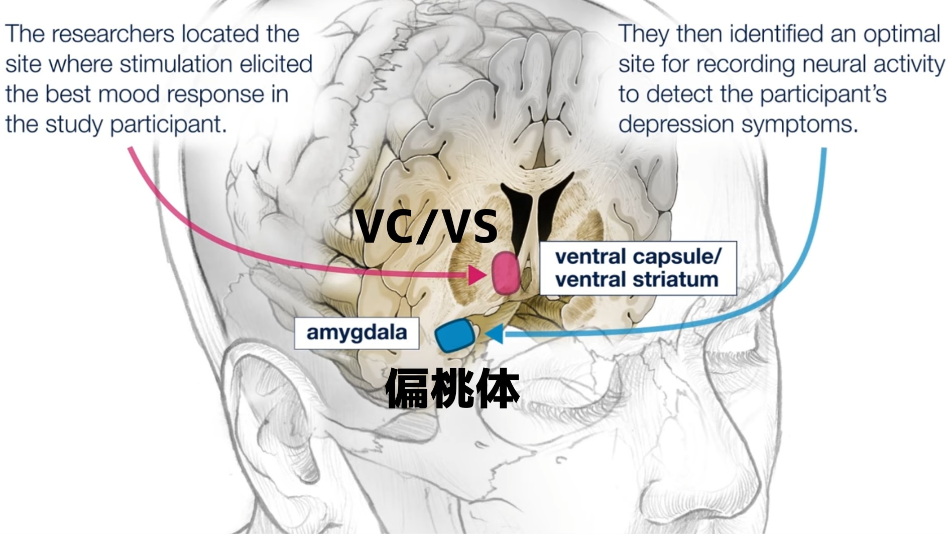 偏桃体とVC/VSの位置