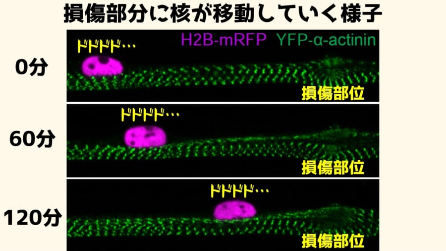 筋肉の傷に「核」が集まってくる新現象を発見！　