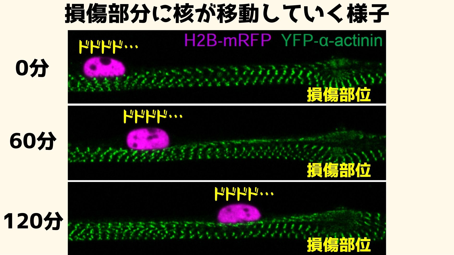 筋肉の傷に「核」が集まってくる新現象を発見！　