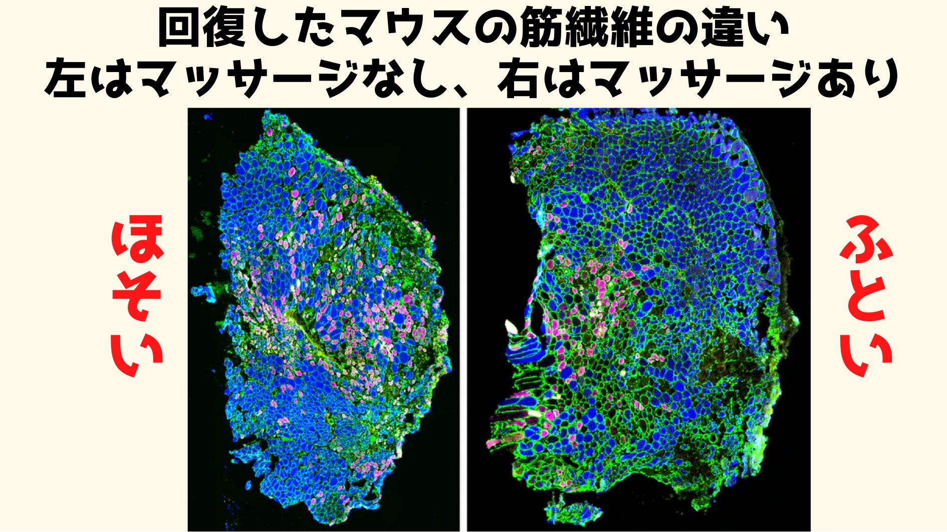 マッサージ効果の科学的解明に成功！　炎症物質を洗い流して回復速度を2倍にしていたの画像 3/7