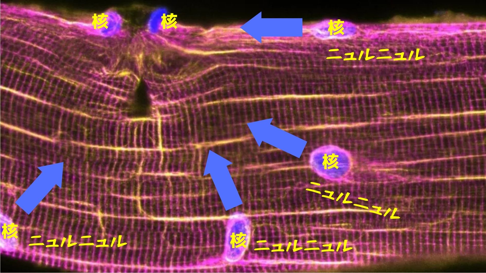 筋肉の傷に「核」が集まってくる新現象を発見！　