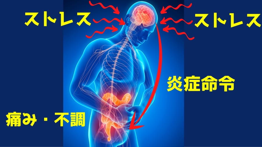 ストレスによって脳の病気記憶回路が活性化し内臓に炎症を引き起こしている