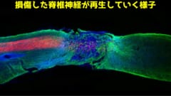 振動する超分子薬で脊椎を損傷したマウスを再び歩かせることに成功！