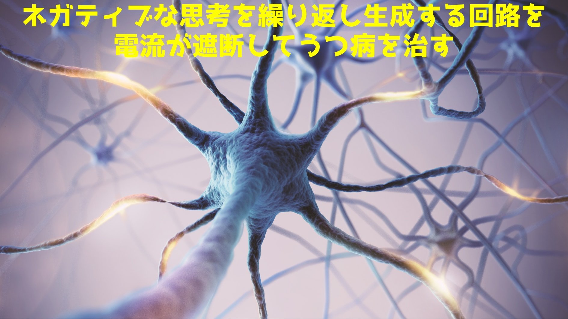 電気刺激はβ波を抑えてネガディブな思考回路を遮断した