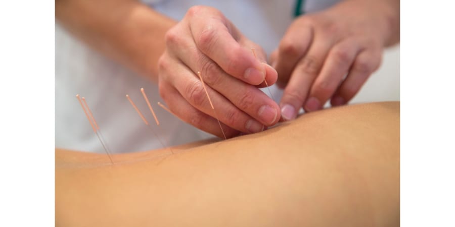 鍼治療のツボの正体」を解剖学的に示すニューロンが発見される
