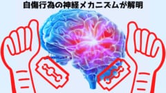 リスカなど自傷行為の根底にある脳のメカニズムを解明！