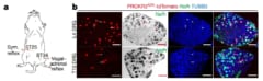 PROKR2の発現によって特徴づけらた感覚ニューロン。腹部より後肢に多く存在している。