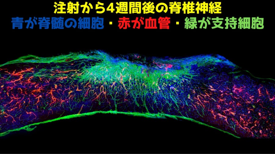 振動する超分子薬で神経細胞にポケモンショックを与えて再生させる