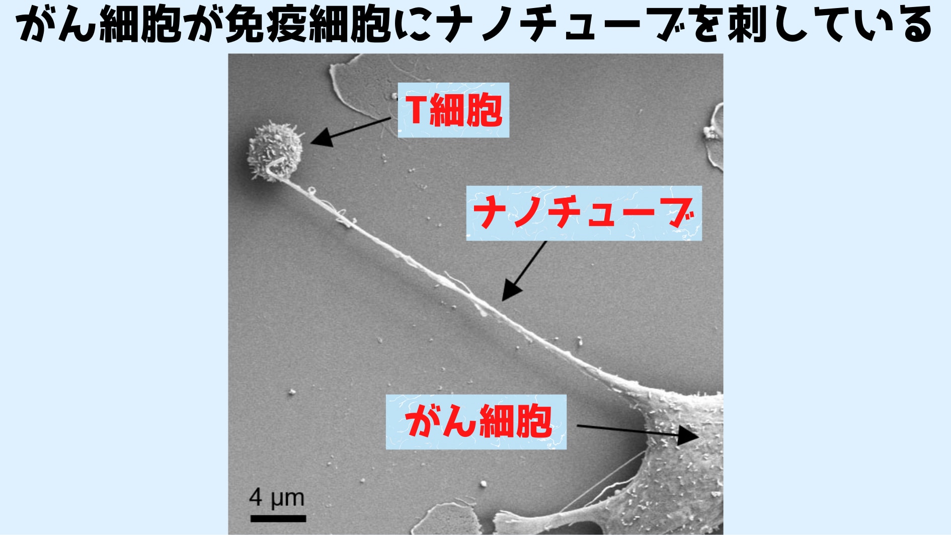 がん細胞が免疫細胞からミトコンドリアを吸っていると判明！