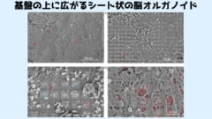 脳オルガノイドは無数の電極を配置された基盤と結合している