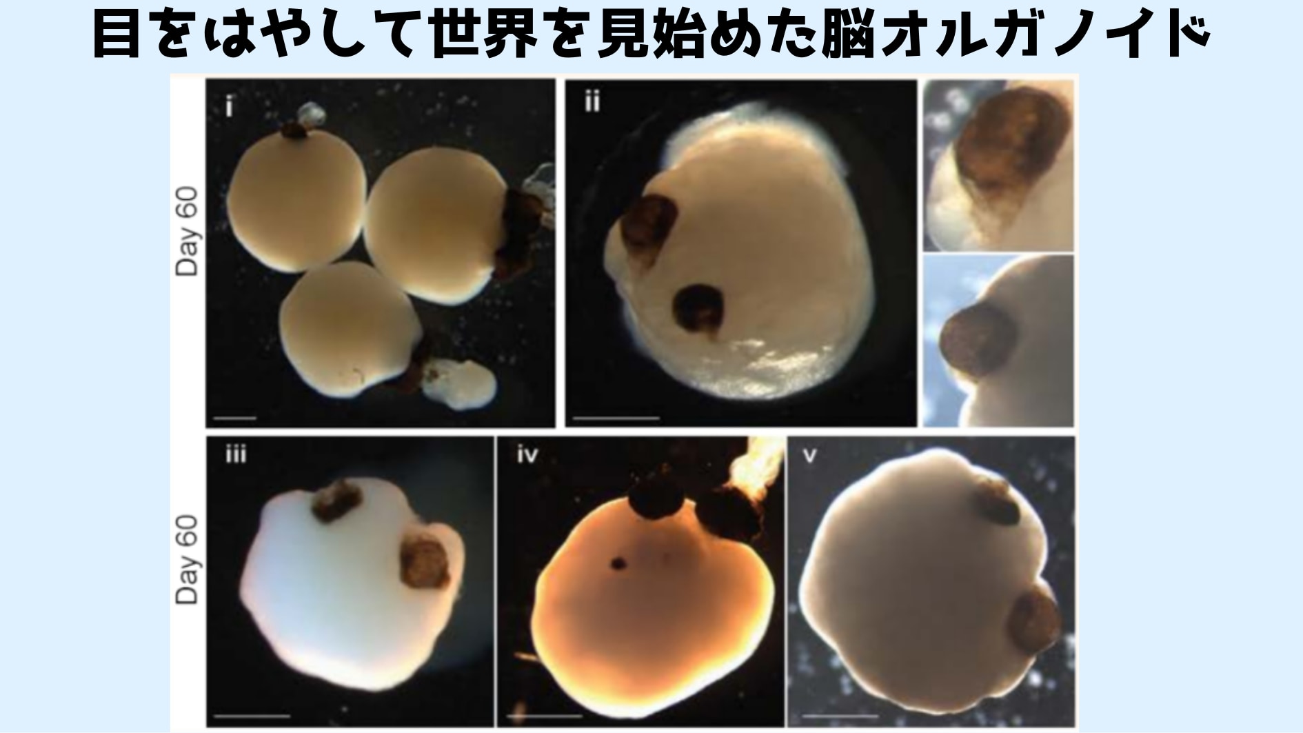 以前の研究で作成された目を持つ脳オルガノイド