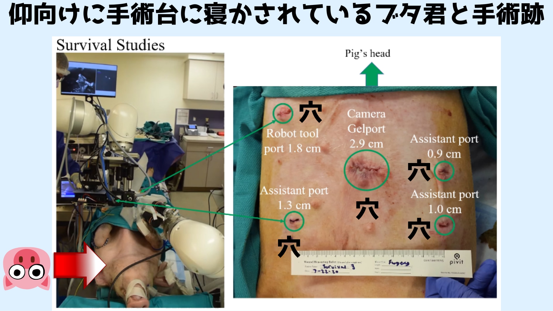 自律型ロボットがブタの腸を縫い合わす「自動」腹腔鏡手術に成功