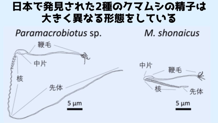 先体と核があわさって頭部を形成している。人間のオタマジャクシ型とは大きく異なる