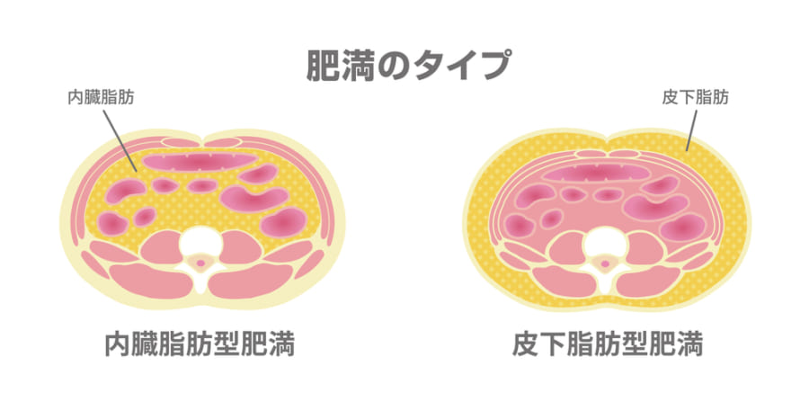 内臓脂肪と皮下脂肪