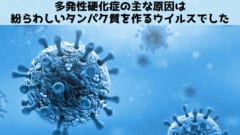 多発性硬化症はウイルス感染が原因だった