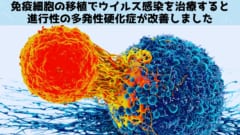 免疫細胞の移植で多発性硬化症の改善に成功！　原因ウイルスを標的に